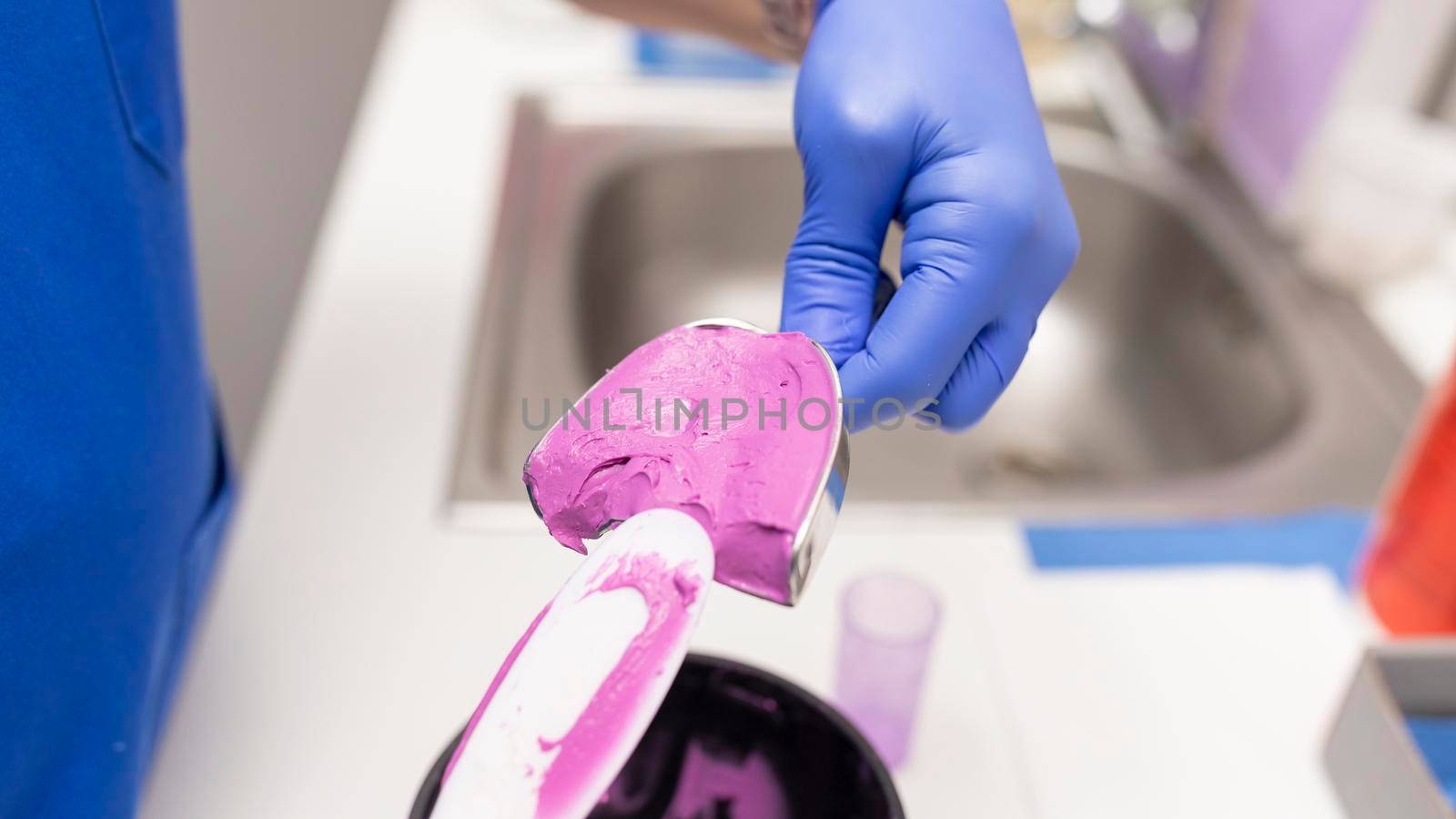 Dentist hands placing purple gum into an impression tray at the dental clinic by stockrojoverdeyazul