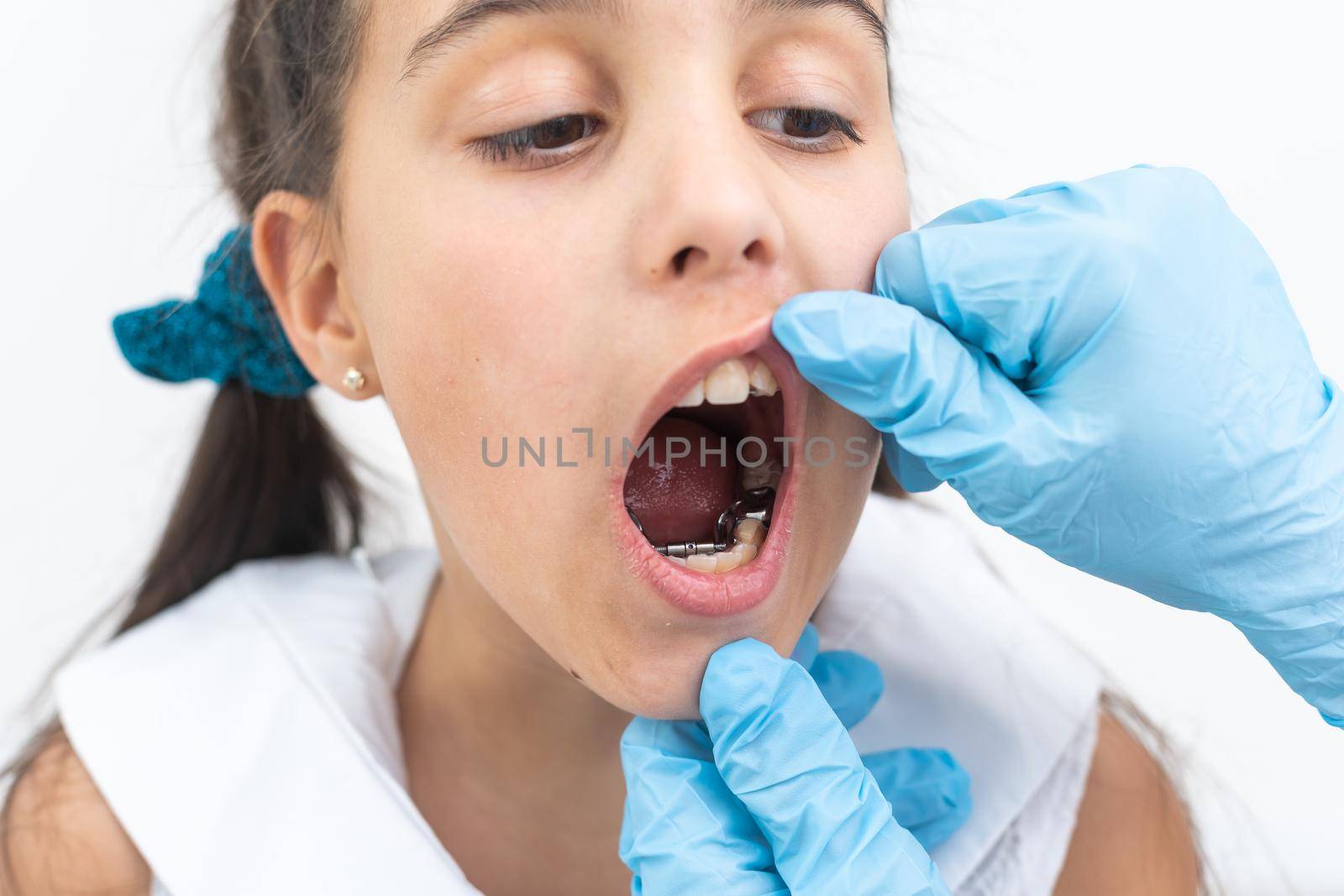 Cropped view of the little girl having her plates checked. Close-up portrait of smiling teenage girl with teeth plates against dentist sitting in clinic. Girl with plates being examined by dentist.