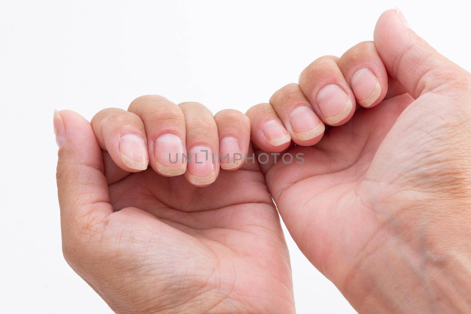 Woman hands showing nails without polish on white background by TatianaFoxy