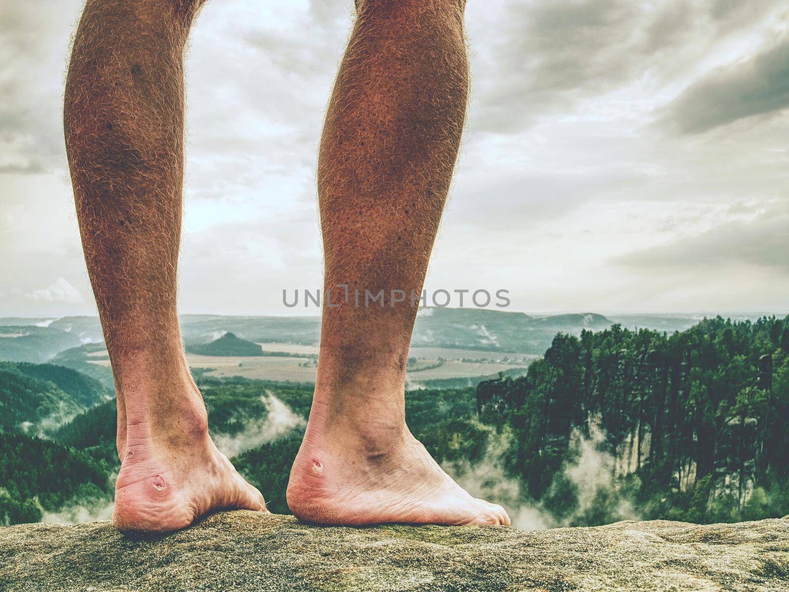 The crossed legs take a rest on tiring mountain trail. Sweaty male legs without trousers relaxing on peak of mountain above valley.