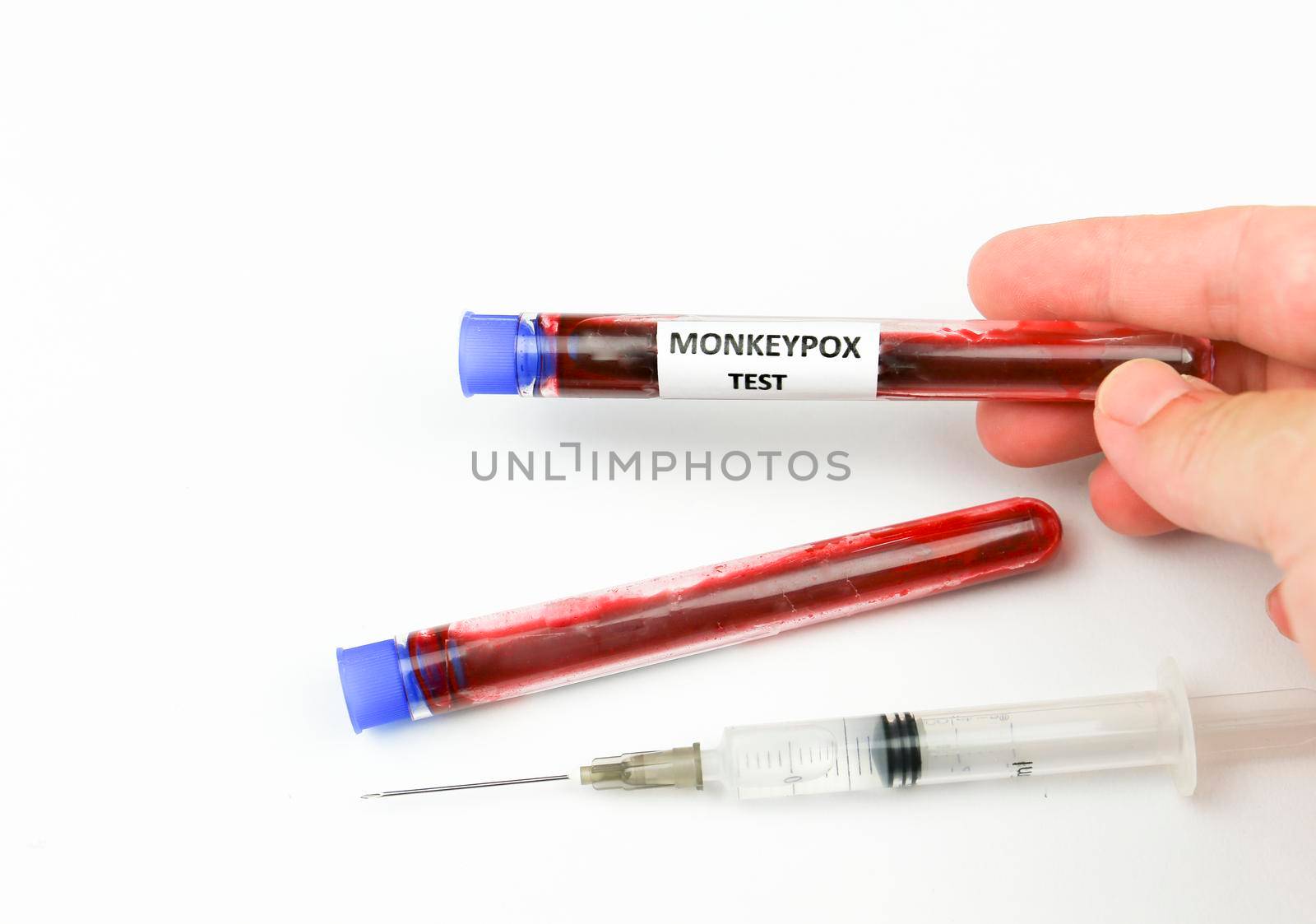 Hand holding Test tube filled with blood for testing and syringe with Monkeypox vaccine