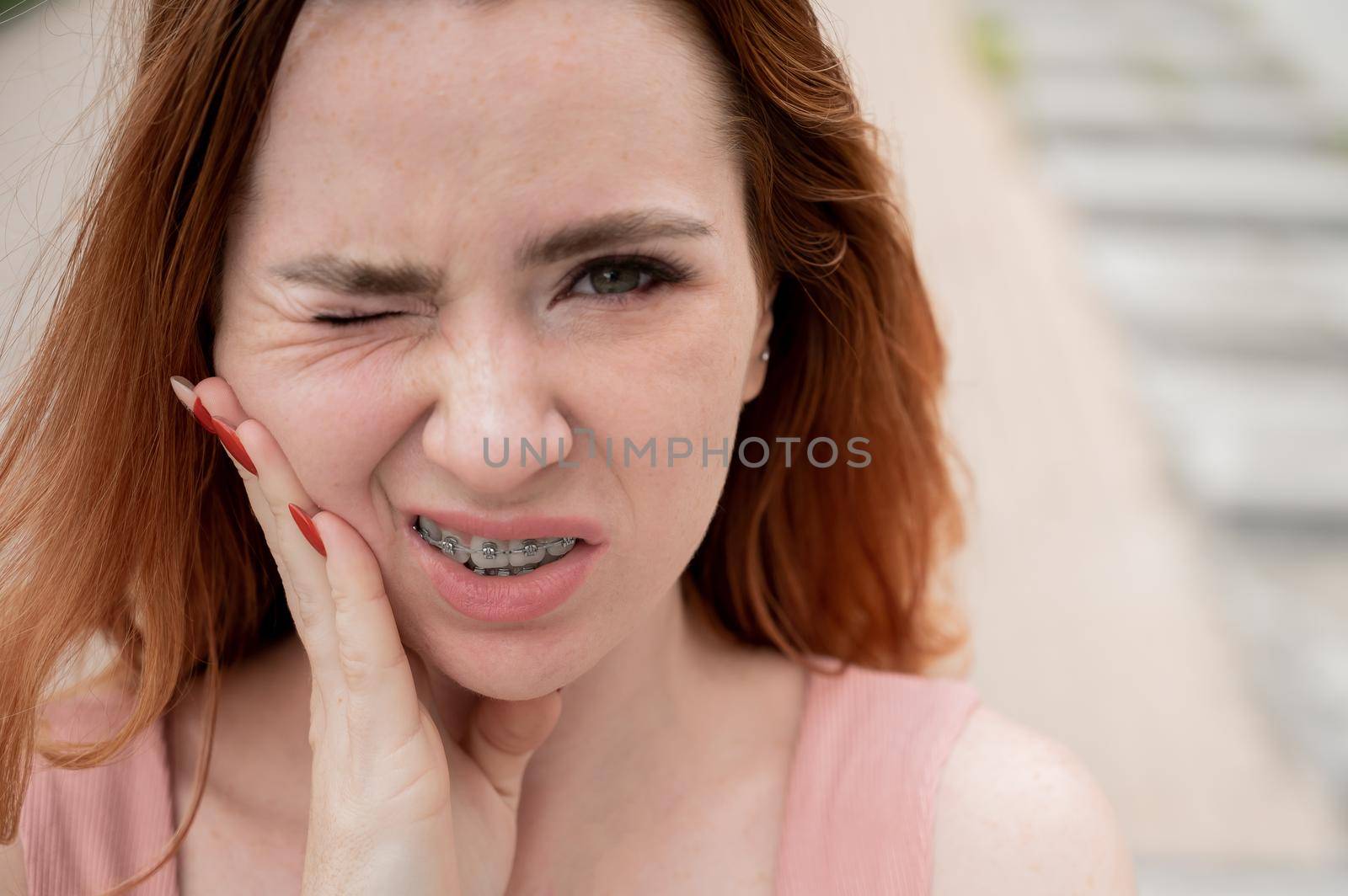 Young red-haired woman with braces suffering from pain. by mrwed54