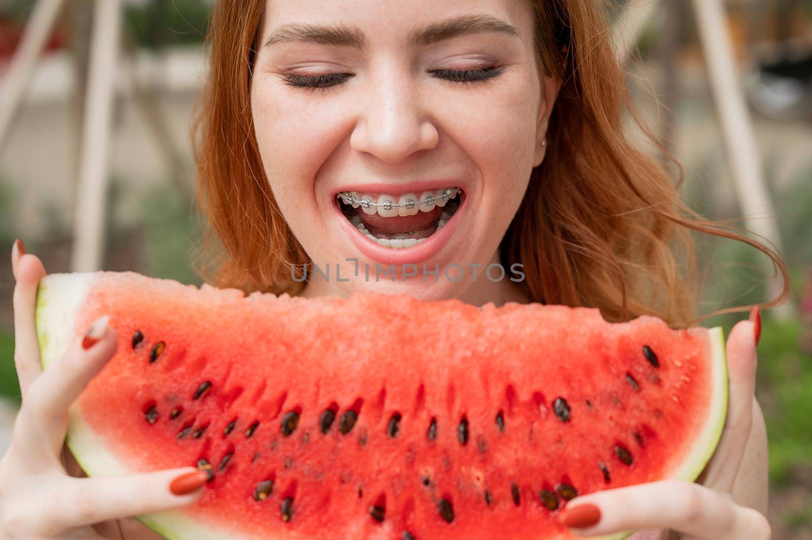 Beautiful red-haired woman smiling with braces and about to eat a slice of watermelon outdoors in summer.