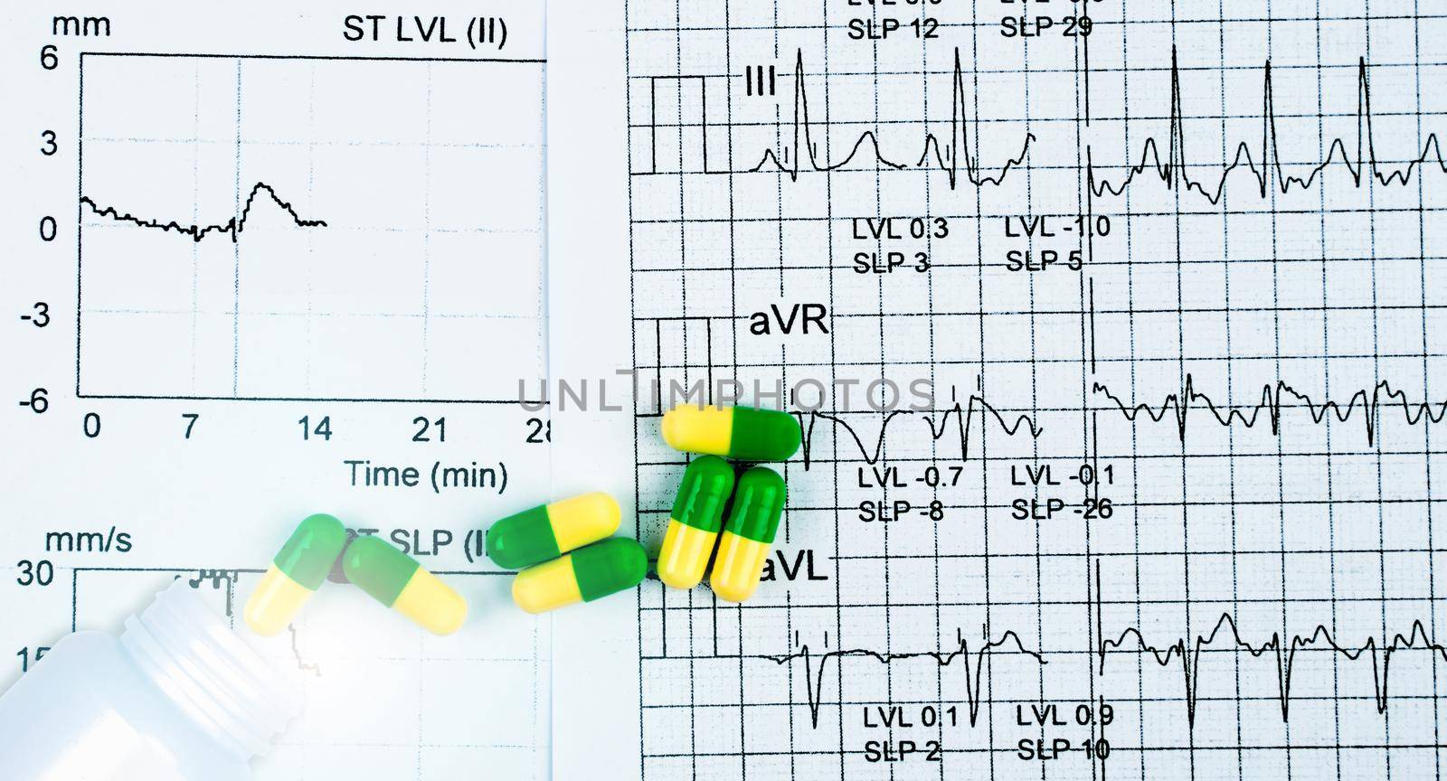 Green-yellow capsule pills spread out of white plastic drug bottle on EKG or ECG graph report paper. Medicine effect on cardiac function. Heart medication concept. Pharmacology. Prescription drugs.