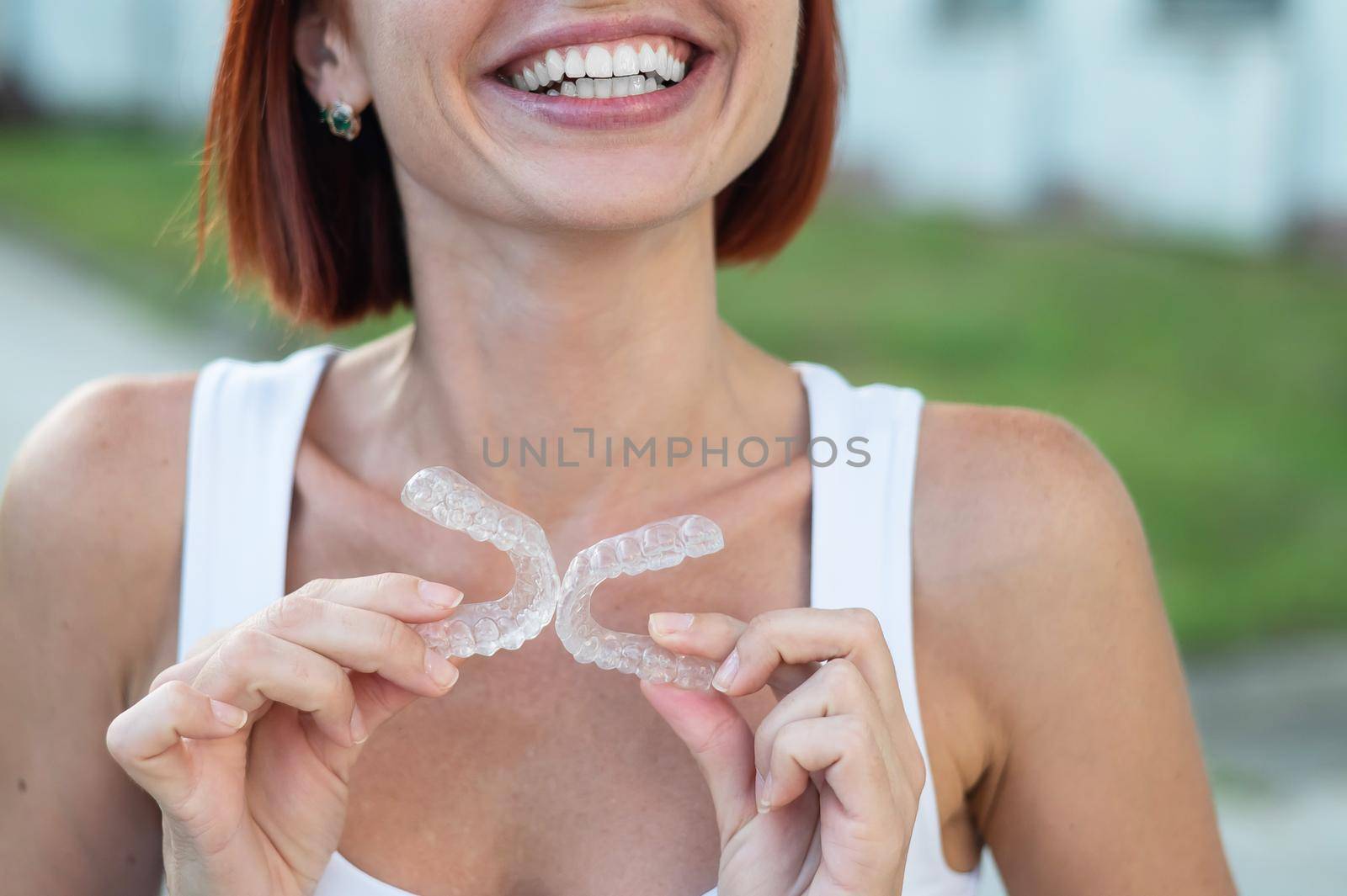 Red-haired Caucasian woman holding transparent mouthguards for bite correction outdoors. A girl with a beautiful snow-white smile uses silicone braces by mrwed54