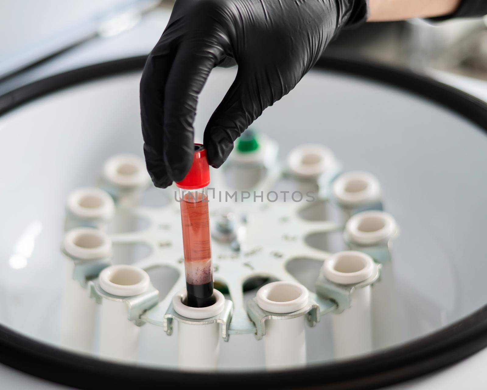 The doctor takes out a test tube with blood plasma from the centrifuge. Plasma lifting procedure for skin rejuvenation. by mrwed54