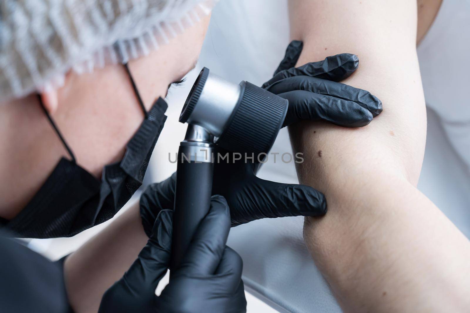 A dermatologist examines a patient's mole through a dermatoscope. by mrwed54