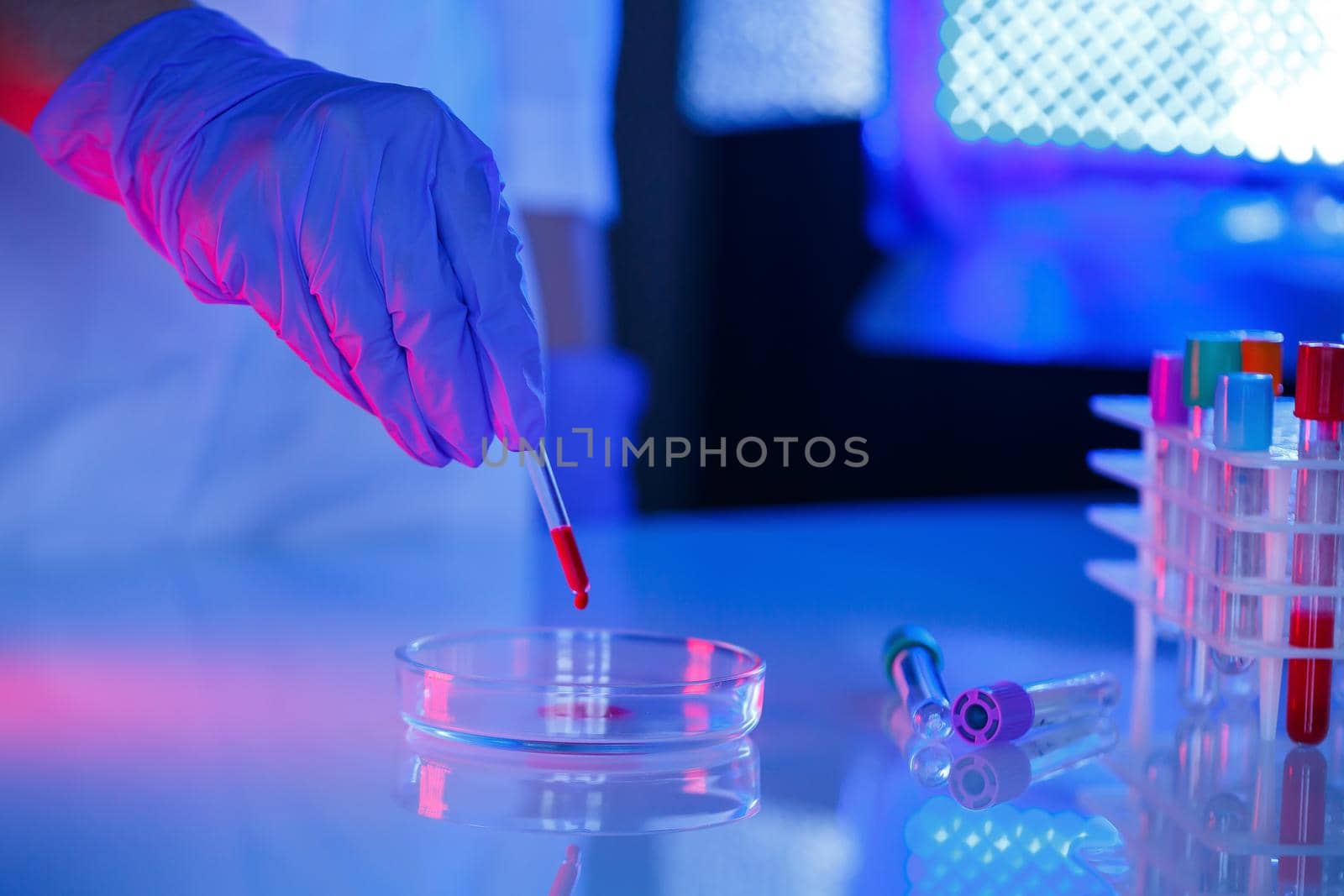 A medical professional, laboratory assistant, doctor performs an analysis in a laboratory, uses test tubes, a pipette and a petri dish for the presence of bacteria in the human body