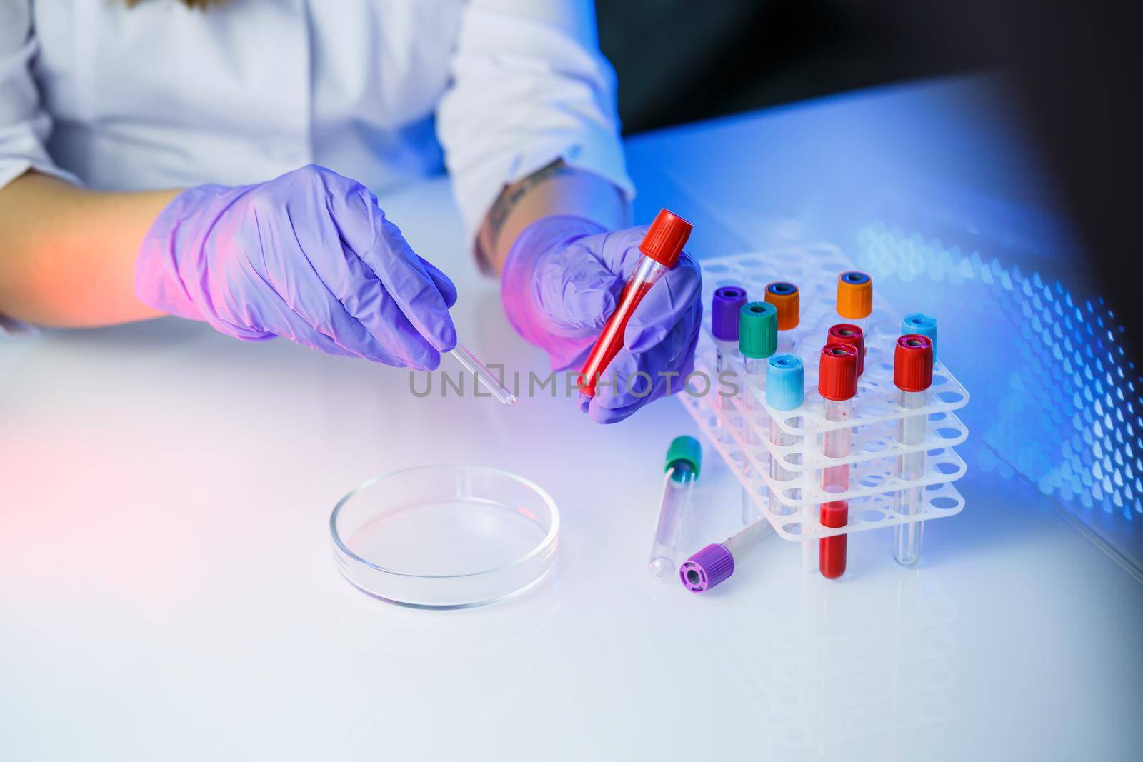 A medical professional, laboratory assistant, doctor performs an analysis in a laboratory, uses test tubes, a pipette and a petri dish for the presence of bacteria in the human body. Selective focus