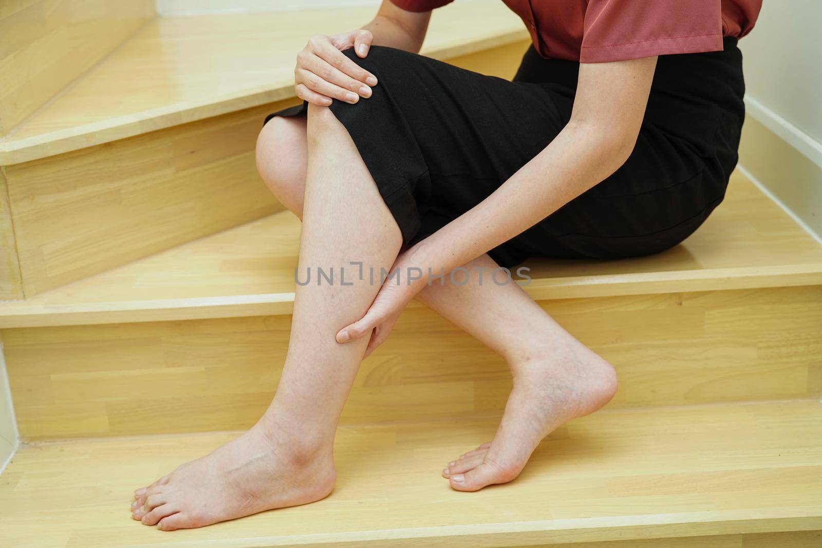Asian lady woman injuries from falling down on slippery surfaces stairs at home.