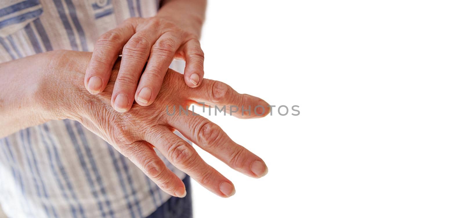 Close-up, white background copy space. An elderly woman applies moisturizing cream-lotion on her palms, relieving pain, experiencing severe arthritic-rheumatic pains, doing a massage, warming her hand