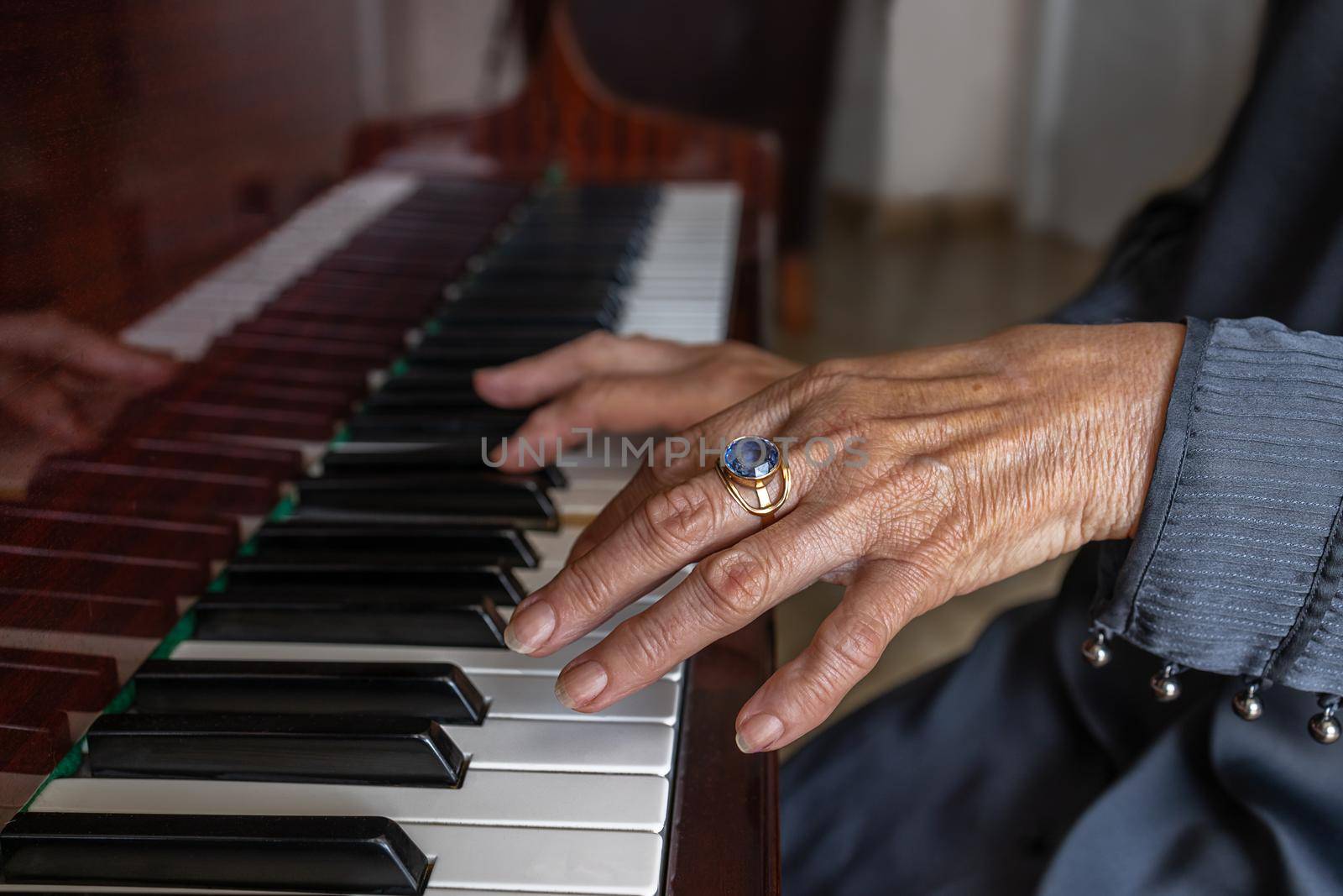 Close-up, hands of an old woman with arthritis