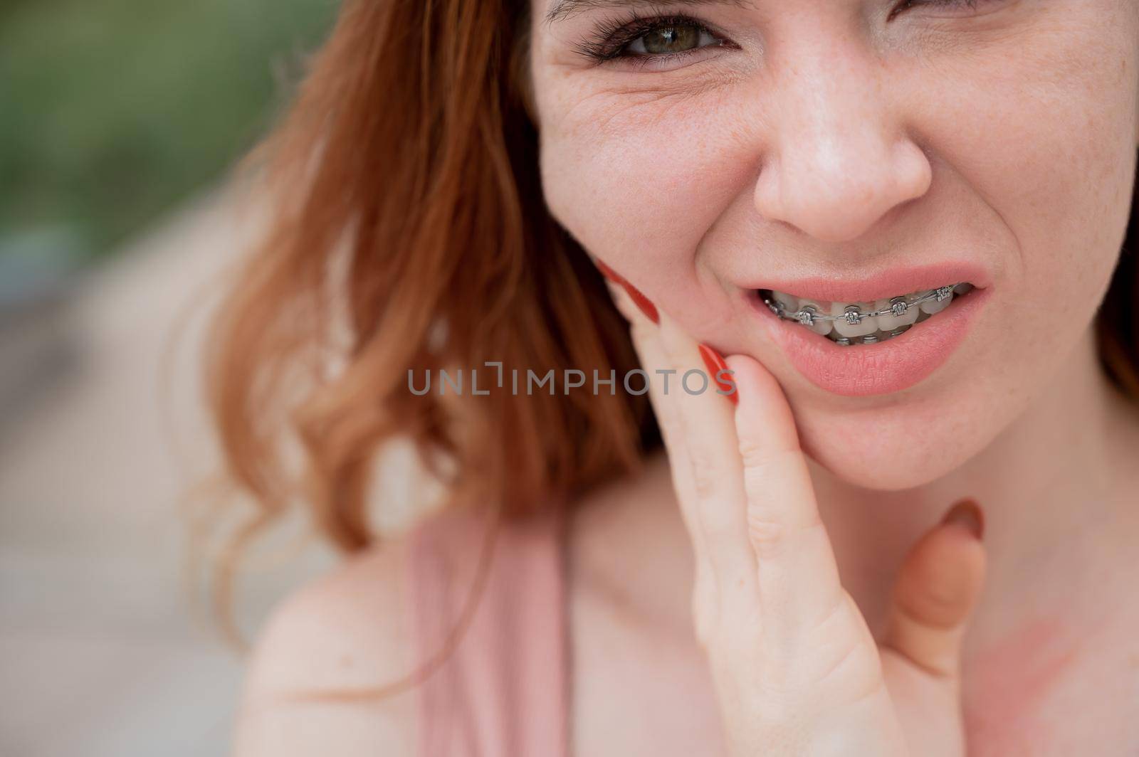 Young red-haired woman with braces suffering from pain. by mrwed54