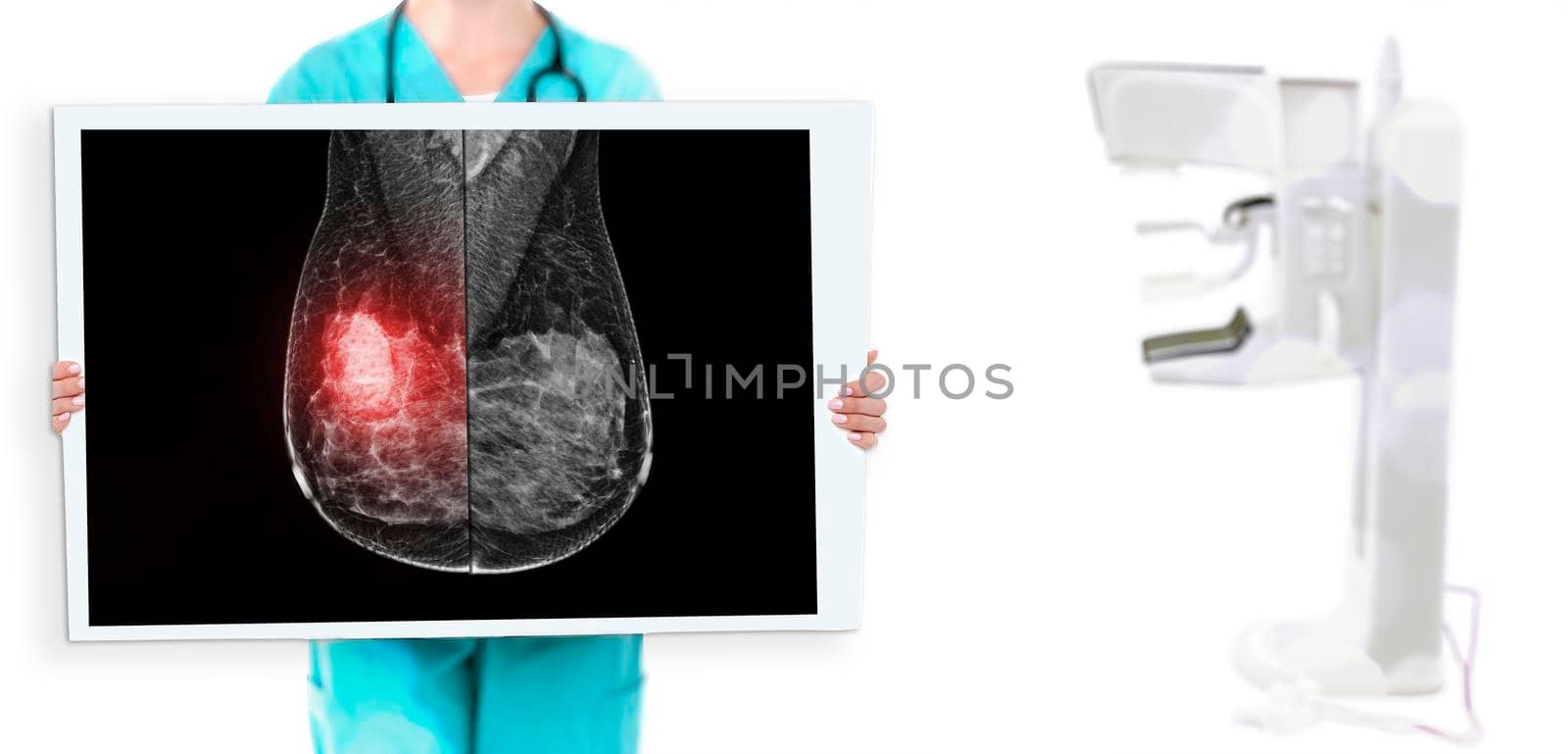 Selective focus female doctor show Mammogram imaging with mammogram device in hospital.