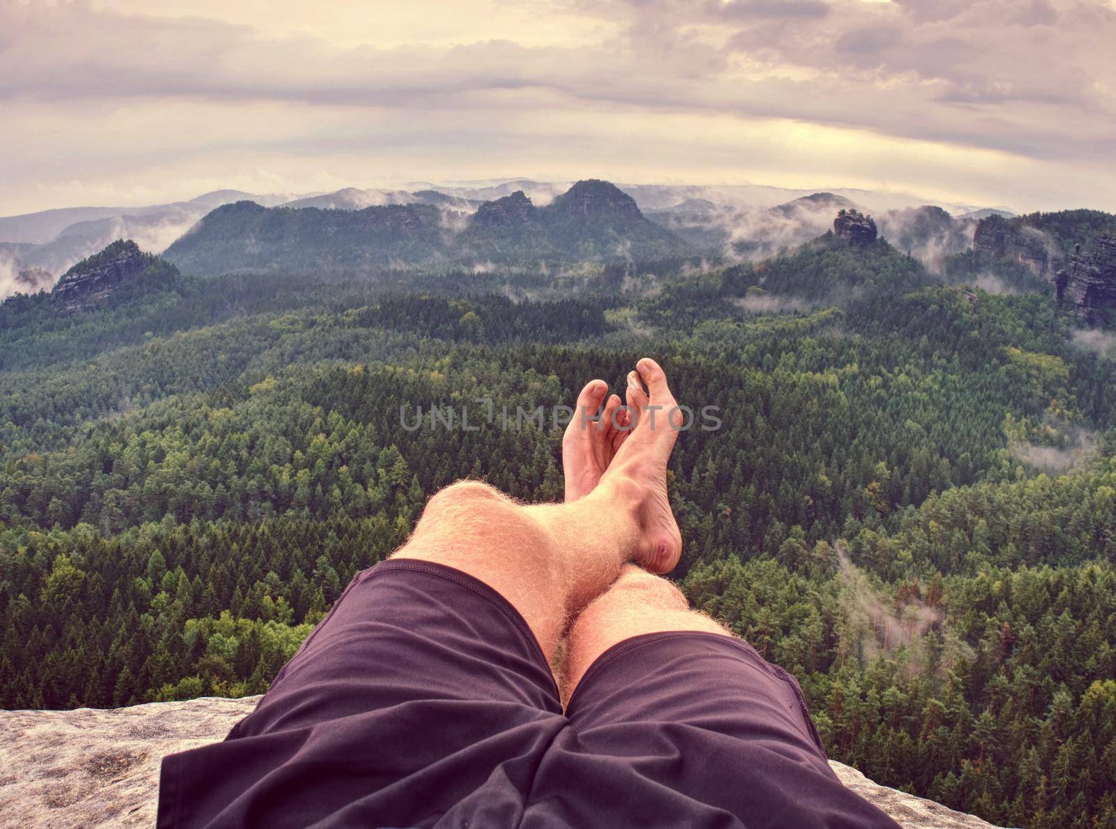 Man hiker sweaty legs with horrible painful callus resting on mountain peak. Misty rocky landscape  with a valley at background