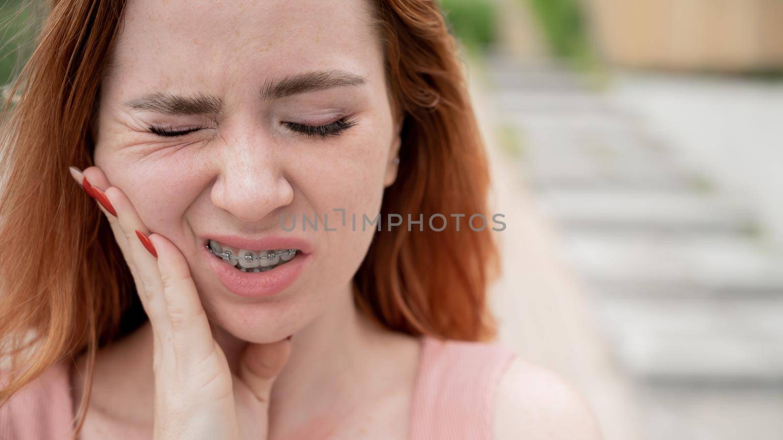 Young red-haired woman with braces suffering from pain