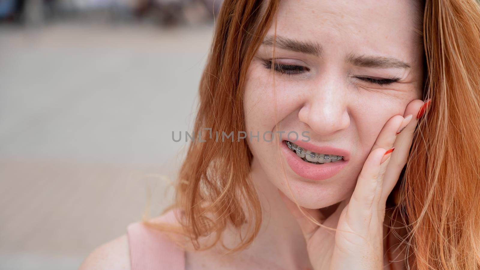 Young red-haired woman with braces suffering from pain