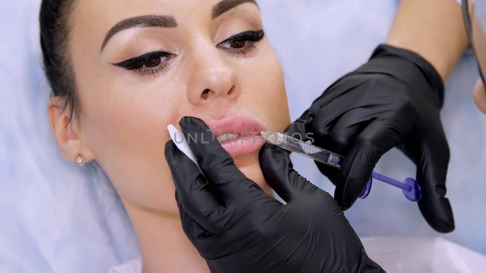 medical office, doctor in black sterile gloves, injecting hyaluronic acid into the patient lips. Procedure for increasing the volume of lips, correction of lips shape. High quality photo