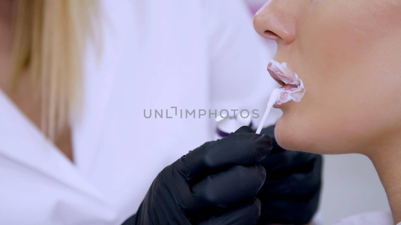 close-up, a cosmetology clinic, doctor applies anesthesia on patient's lips, an anesthetic before injecting hyaluronic acid. an anesthetic ointment on top of patient's lips by djtreneryay