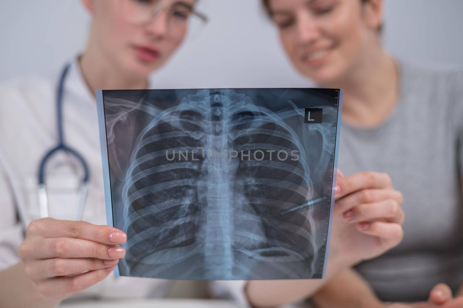 The doctor consults a caucasian woman and comments on the x-ray of the lungs