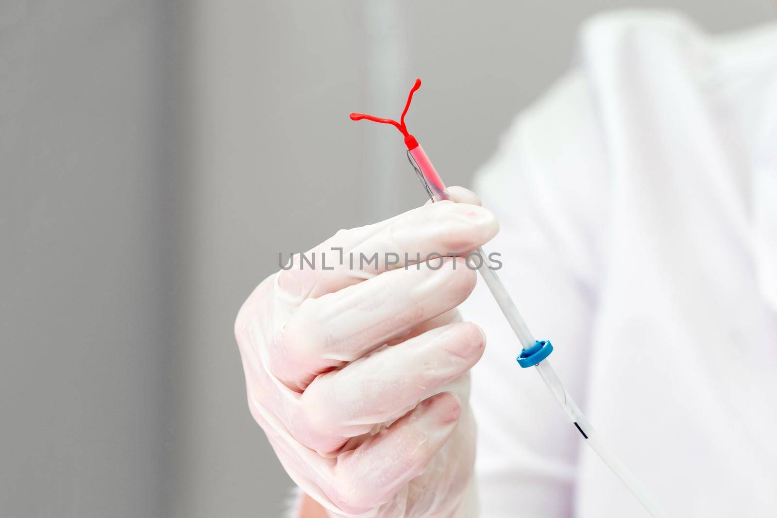 Gynecologist holding an IUD birth control device by Mariakray
