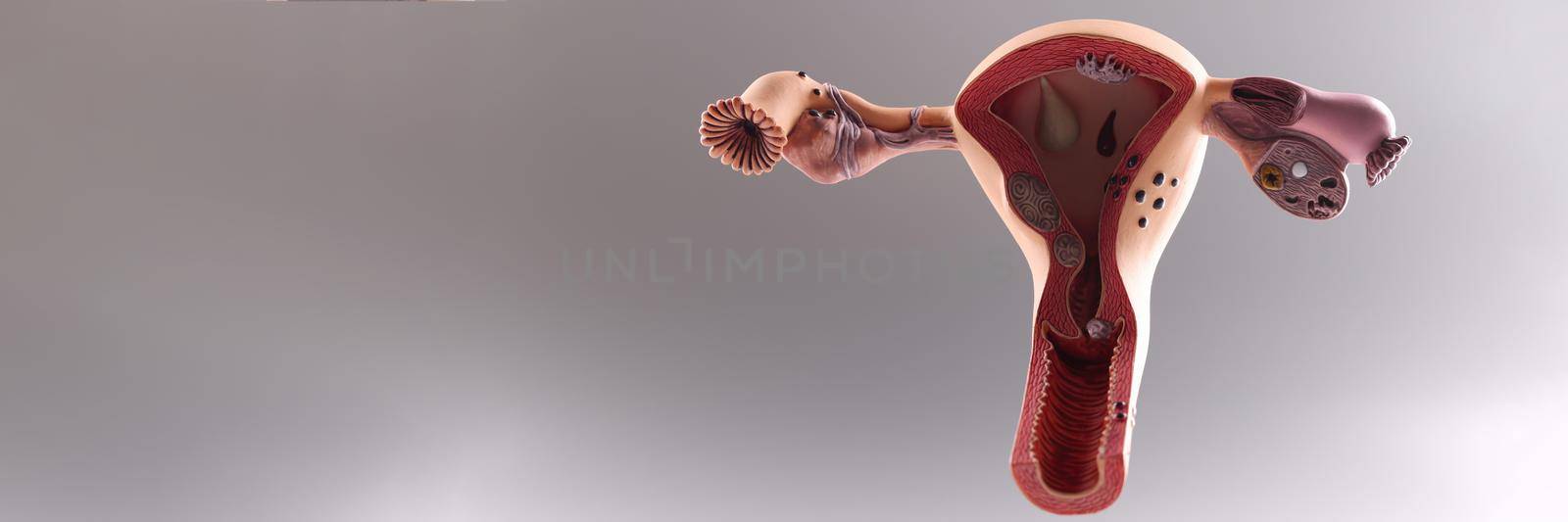 Anatomical model of uterus and ovaries, woman reproductive organs by kuprevich