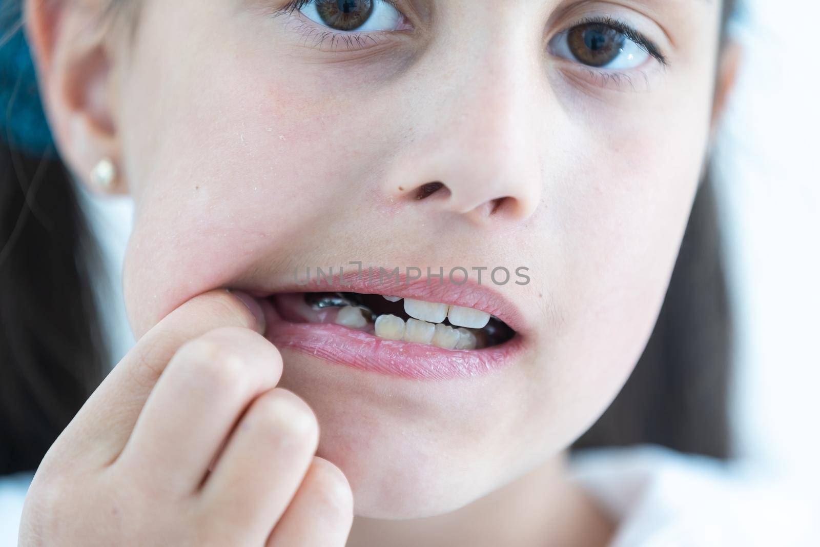 Cropped view of the little girl having her plates checked. Close-up portrait of smiling teenage girl with teeth plates against dentist sitting in clinic. Girl with plates being examined by dentist.