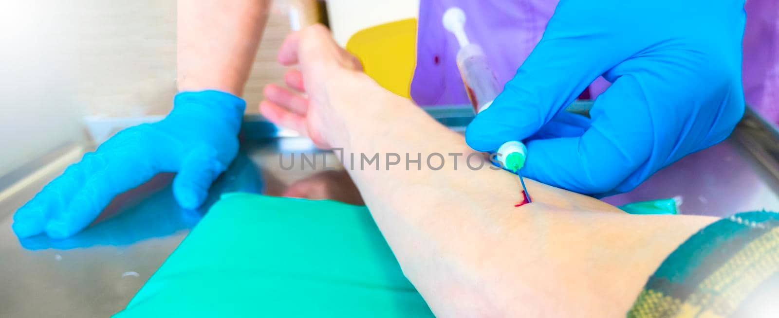 Close up nurse pricking needle syringe in the arm patient drawing blood sample for blood test