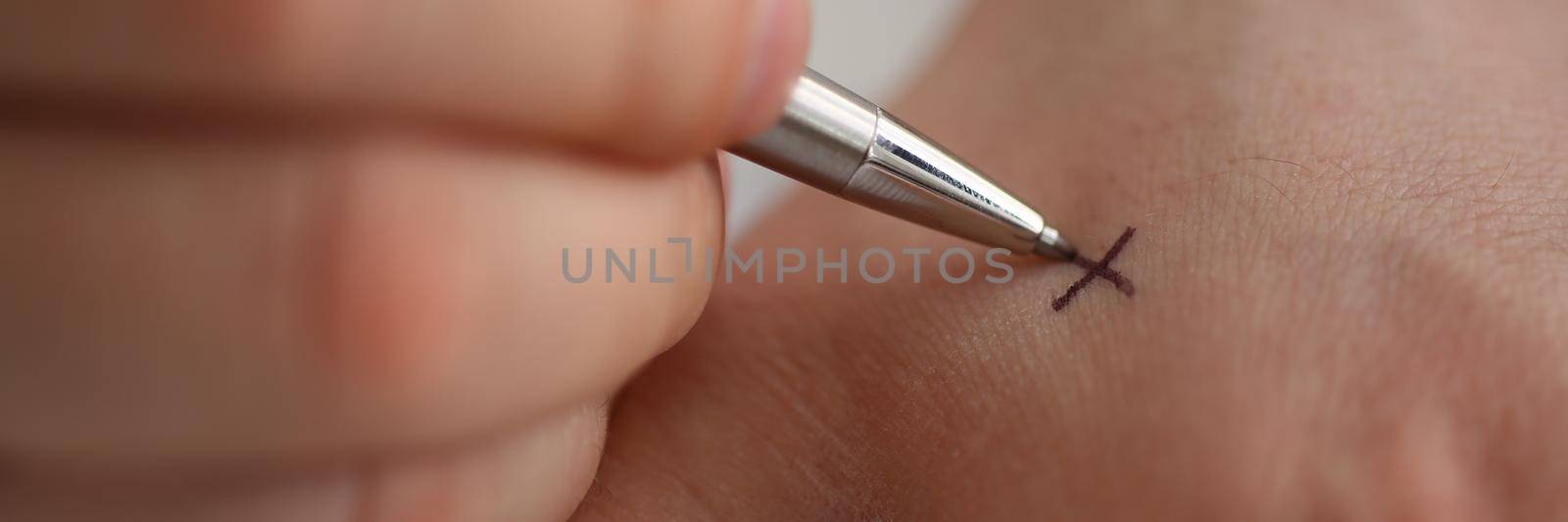 Man makes x note with cross with pen on hand, closeup. Try not to forget to do list concept