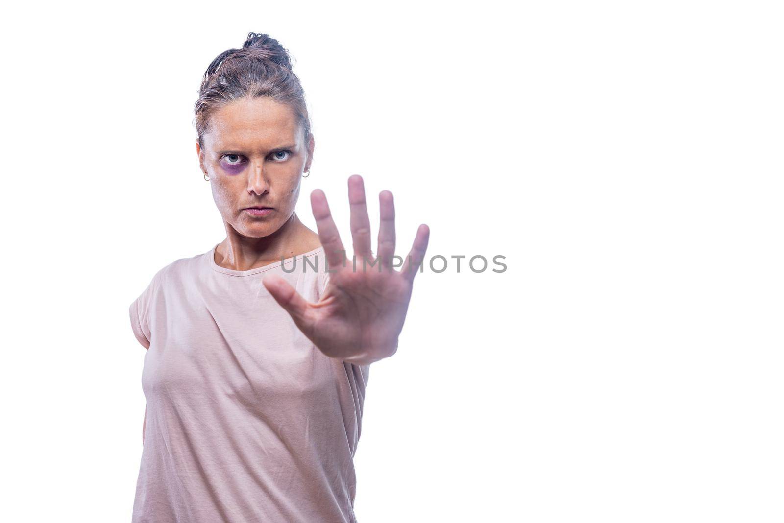 Front view of a green-eyed woman with a bruised eye showing stop sign against gender abuse on a white background with copy space.