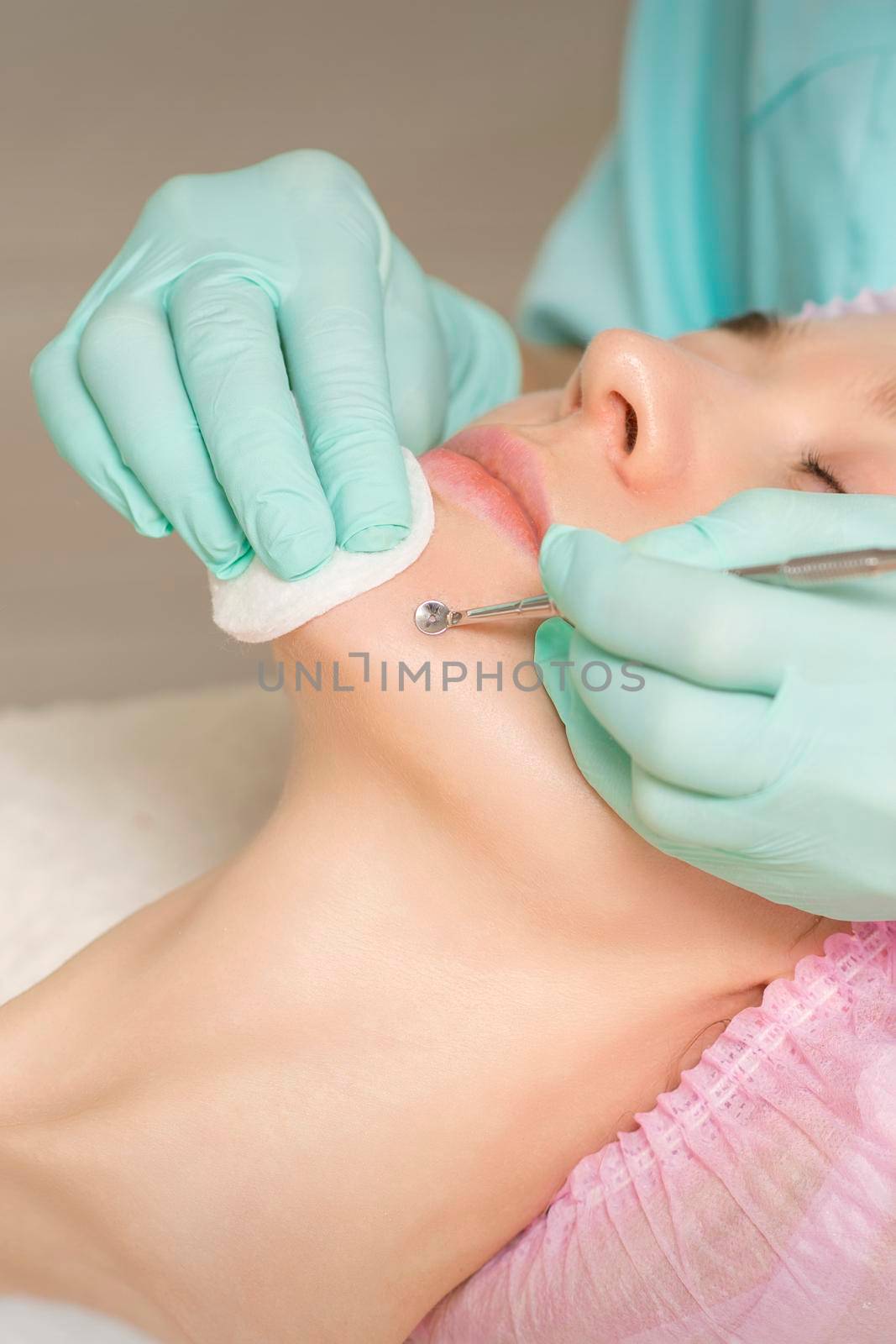 Facial cleansing. Blackhead Removal Tool. Beautician removing blackhead and acne on female chin in a beauty salon