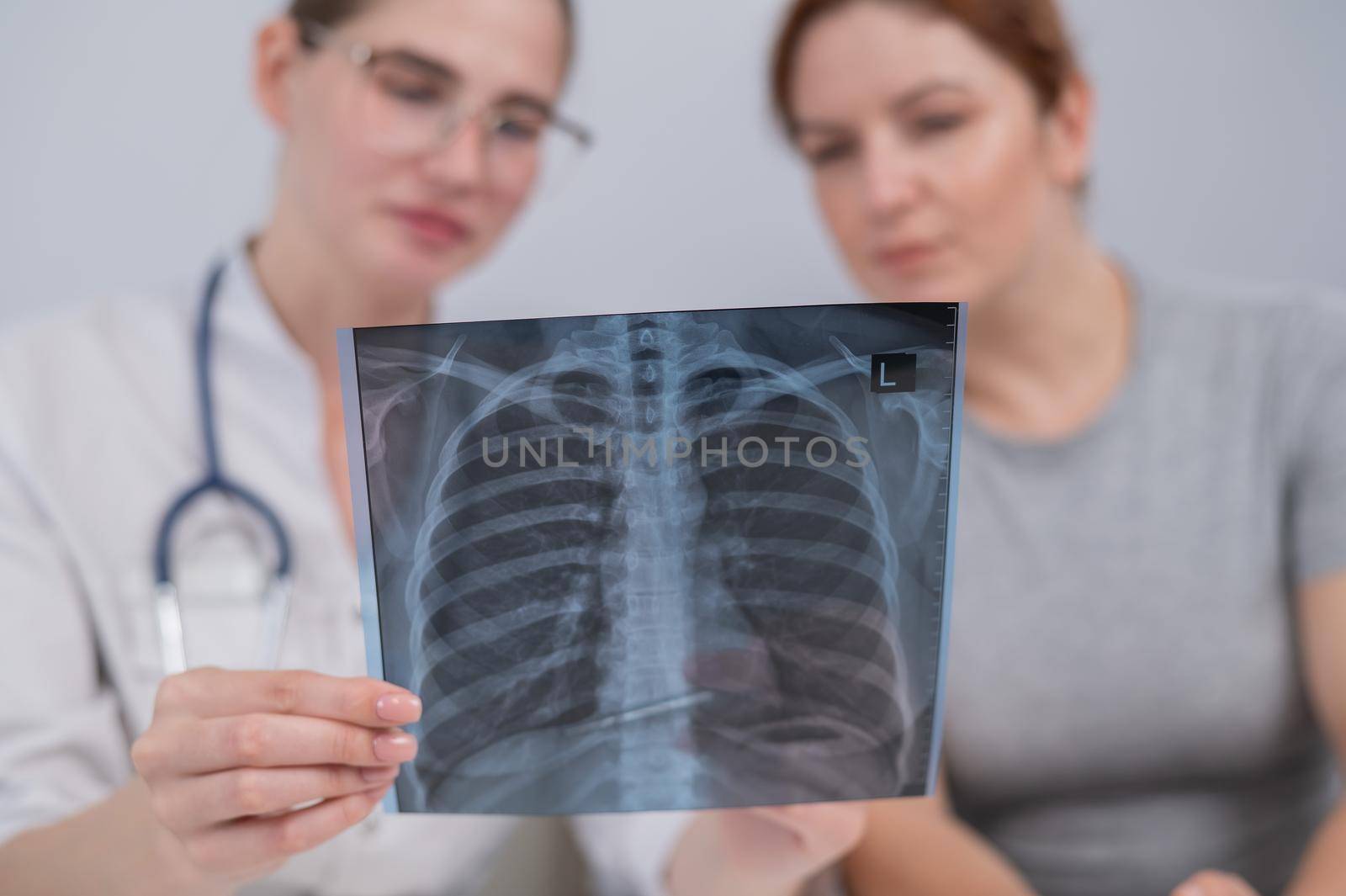 The doctor consults a caucasian woman and comments on the x-ray of the lungs