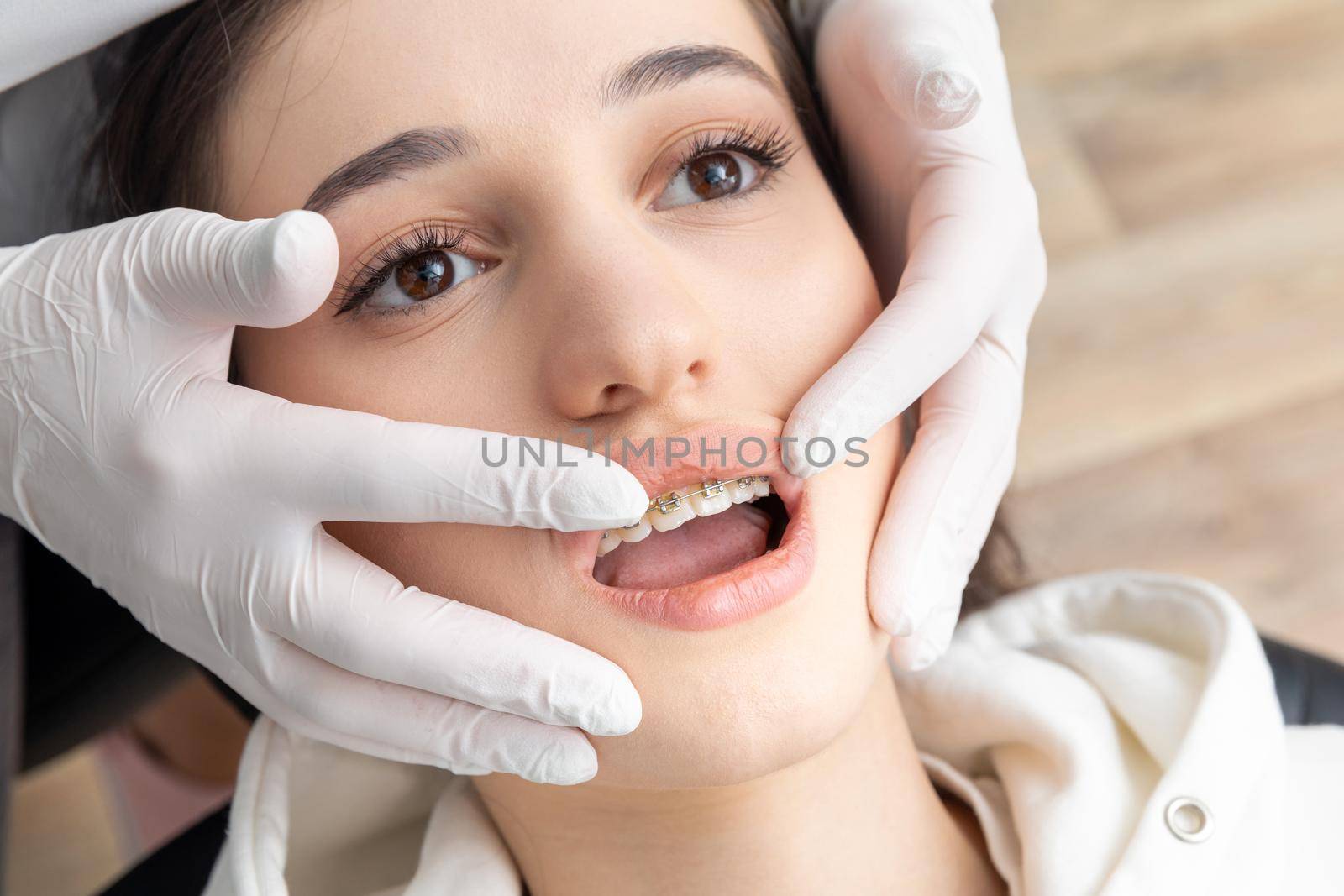 Orthodontist checking brackets on female teeth. Concept of stomatology, dentistry, orthodontic treatment