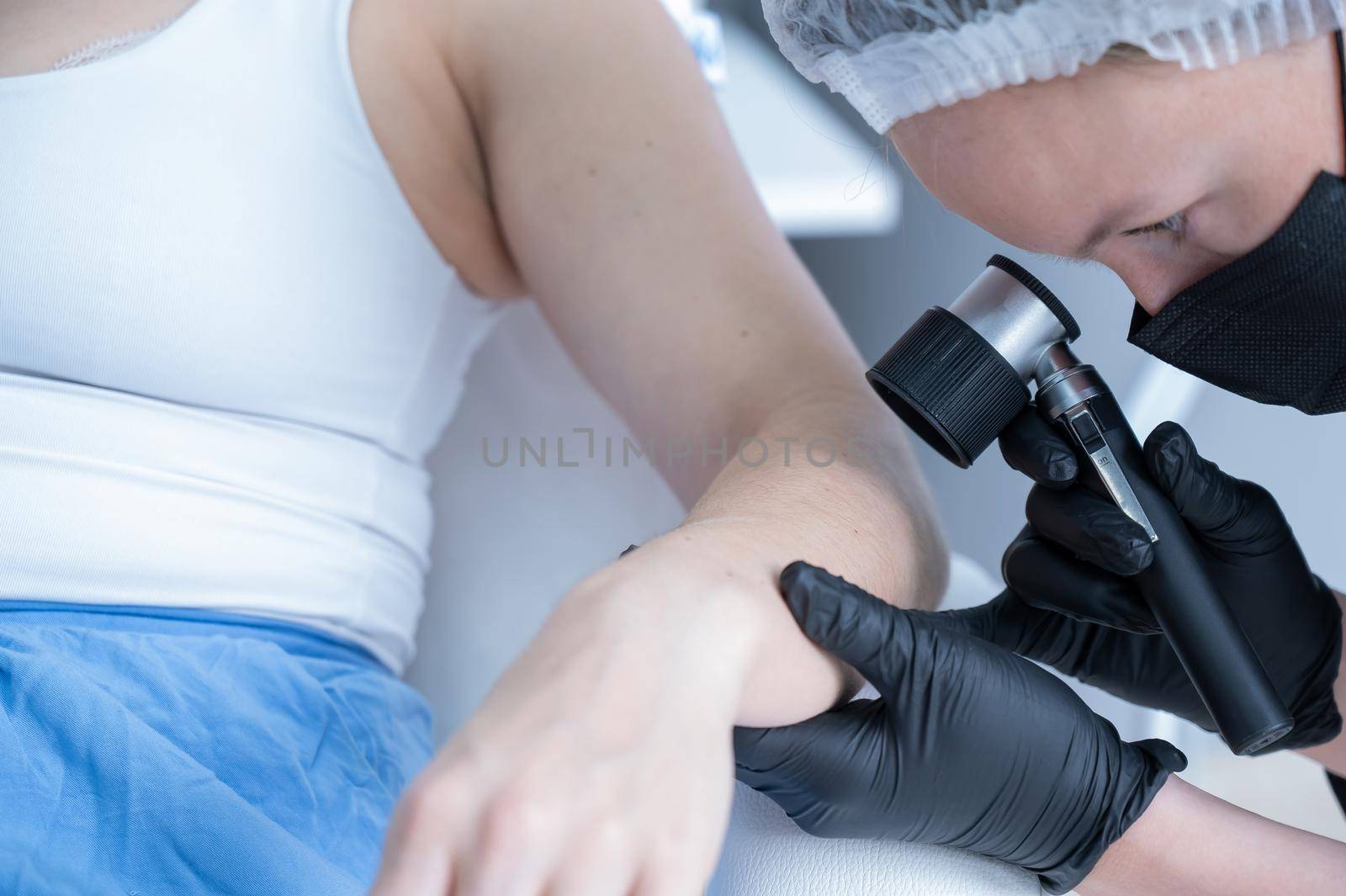 A dermatologist examines a patient's mole through a dermatoscope