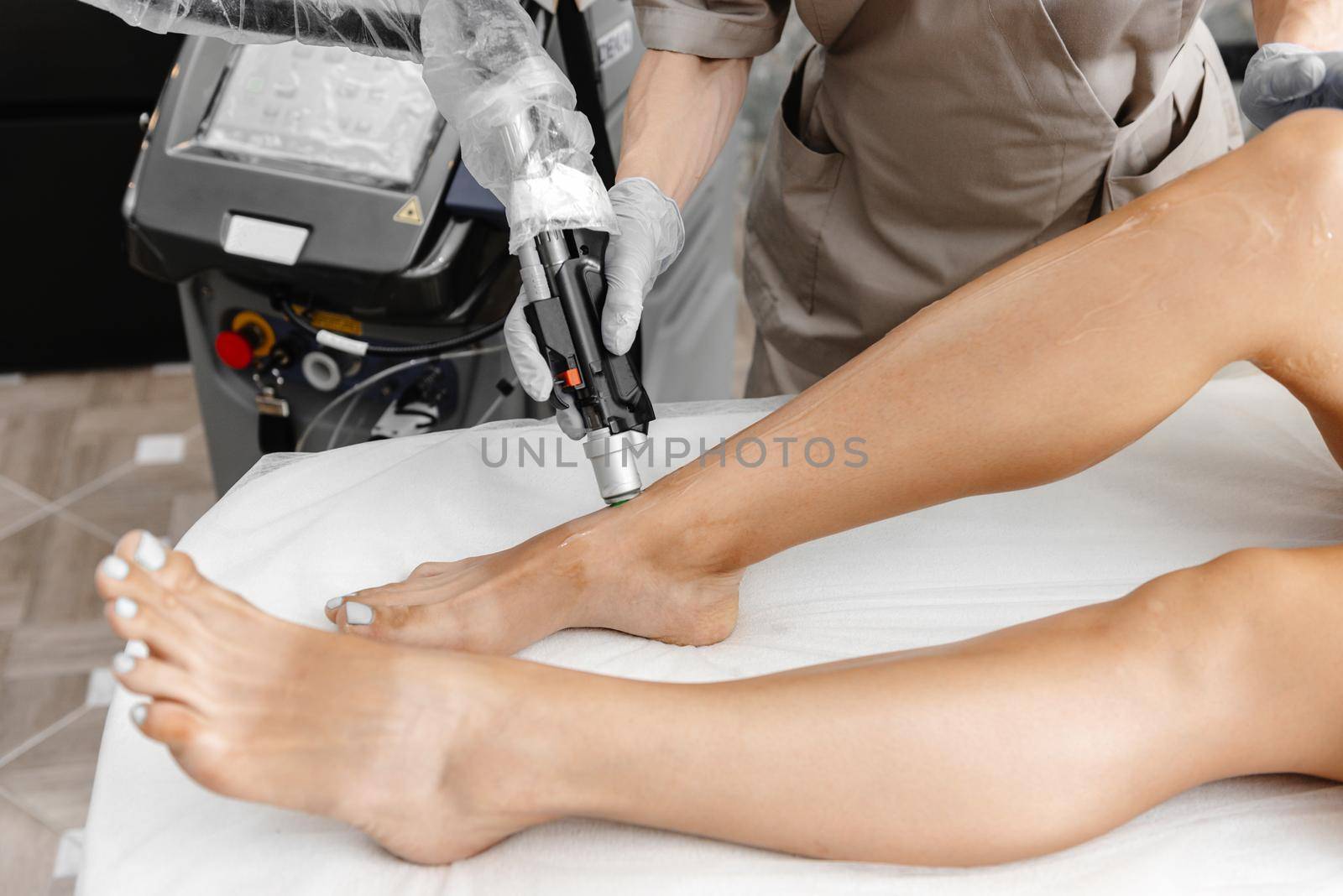 the process of laser hair removal of legs in a large palm. Hair removal with laser