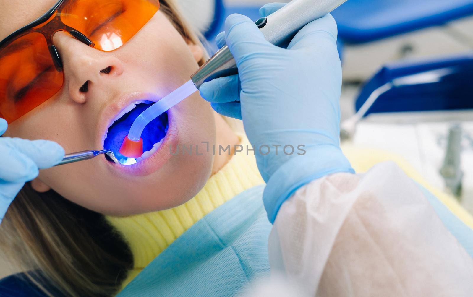 A young beautiful girl in dental glasses treats her teeth at the dentist with ultraviolet light. filling of teeth.