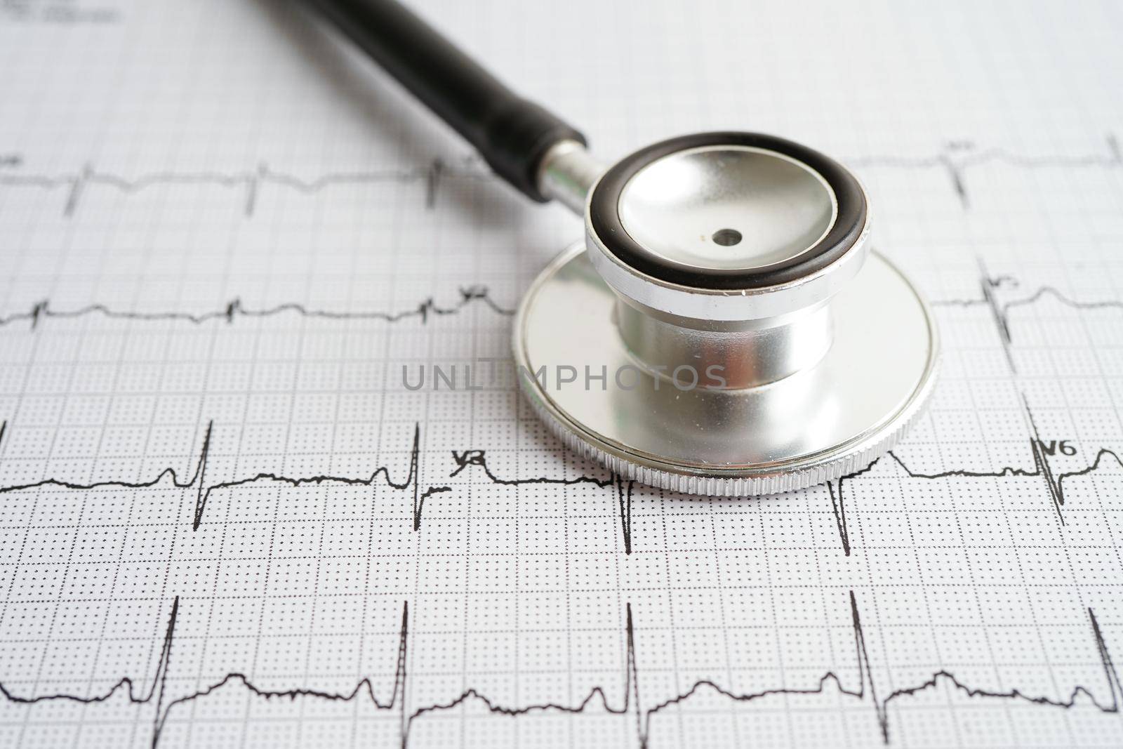 Stethoscope on electrocardiogram (ECG) with drug, heart wave, heart attack, cardiogram report.