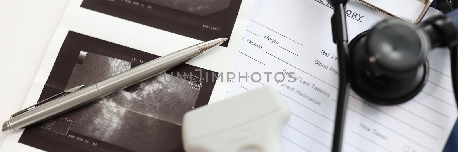 Ultrasound sensor with pictures and stethoscope lying on patient medical history closeup. Ultrasound examination in diagnosis of internal diseases concept