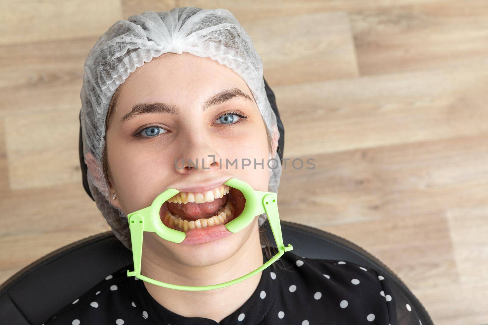 Patient with cheek retractor lying in dentist office in modern clinic