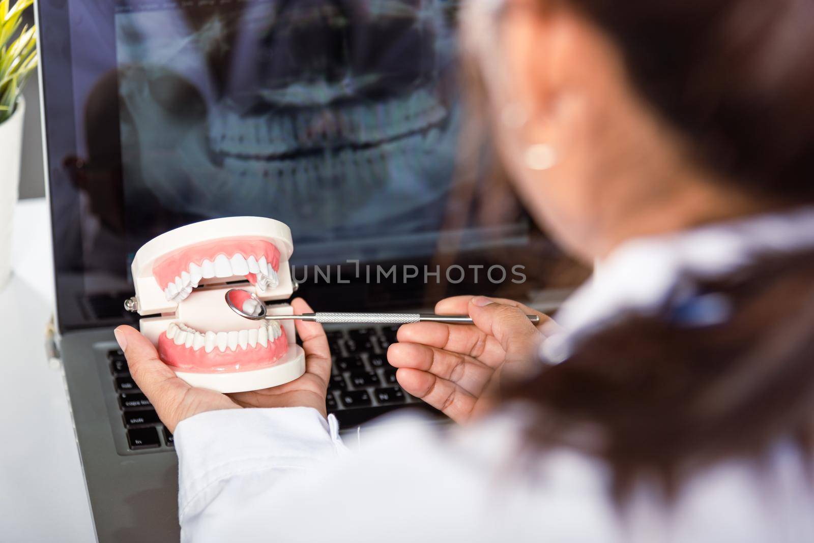 Oral dental hygiene. Dentist healthy white tooth model and explorer mirror tool instrument in dentist explaining to patient at clinic office and teeth X-ray on laptop screen, dental healthcare concept