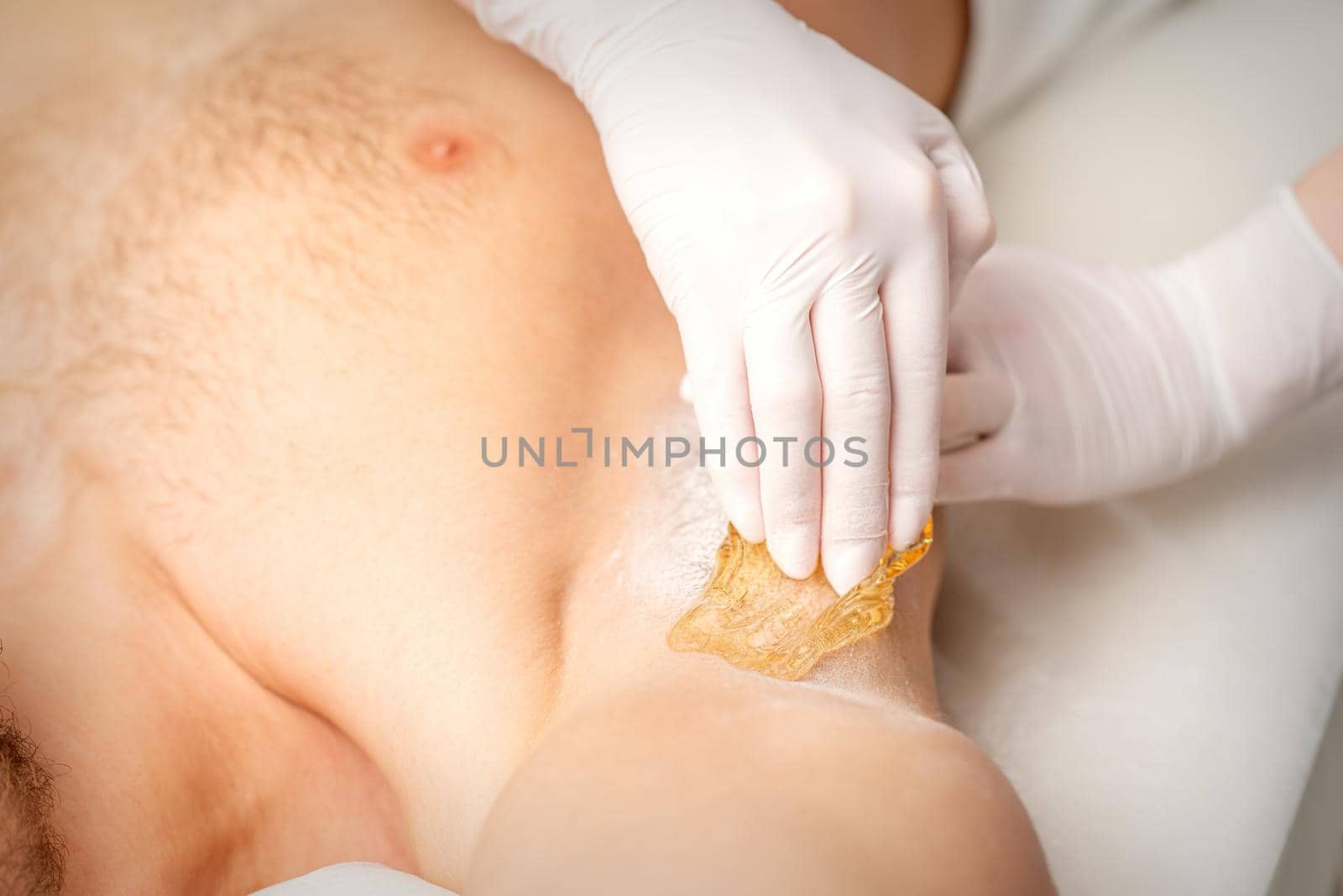 Young caucasian man receiving hair removal from his armpit in a beauty salon, depilation men's underarm