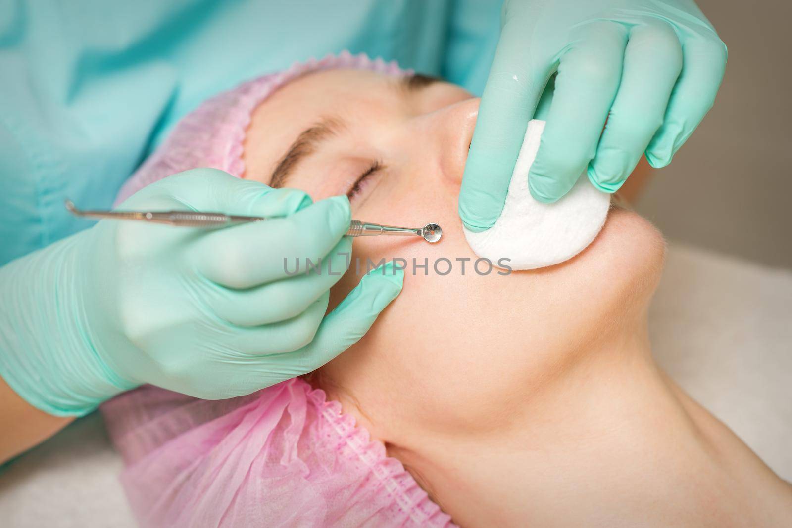 The beautician removes blackhead and acne on the female face in a beauty salon, blackhead removal tool