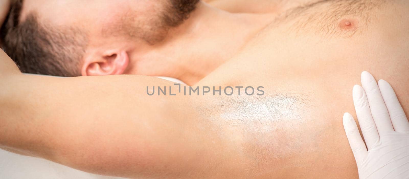 Young caucasian man receiving hair removal from his armpit in a beauty salon, depilation men's underarm