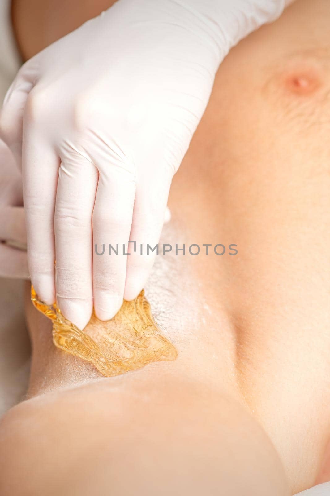 Young caucasian man receiving hair removal from his armpit in a beauty salon, depilation men's underarm