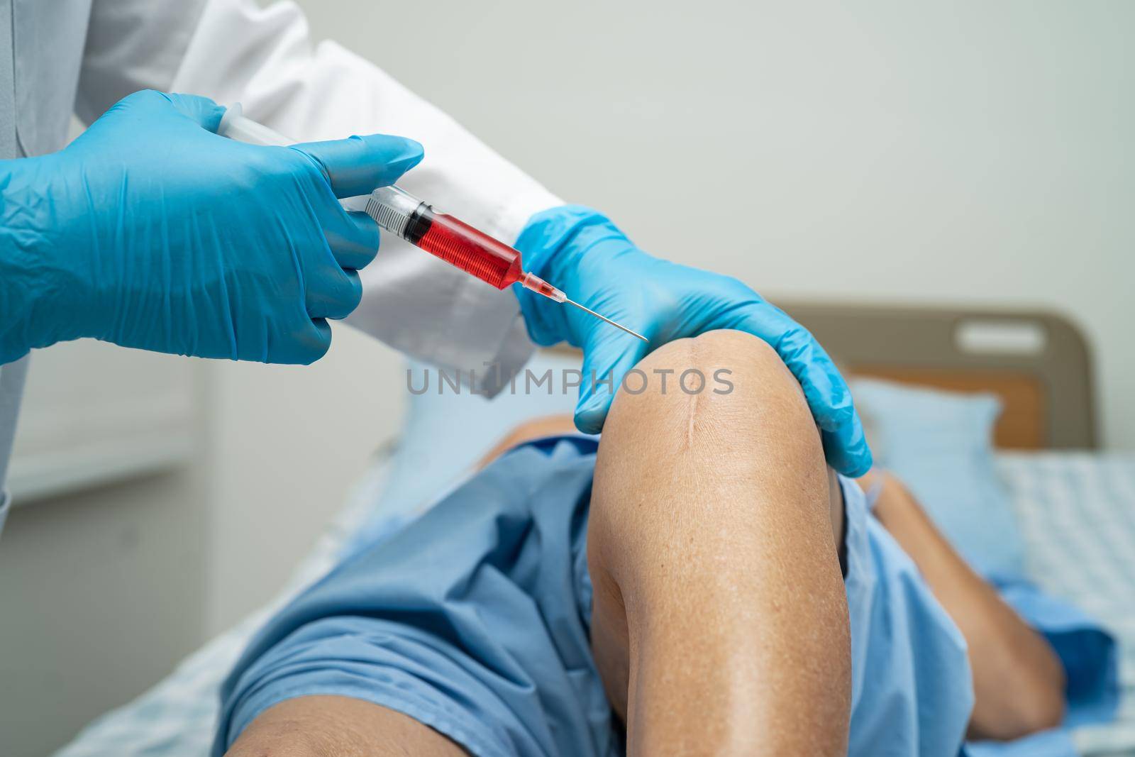 Asian doctor inject Hyaluronic acid platelet rich plasma into the knee of senior woman to walk without pain. by pamai