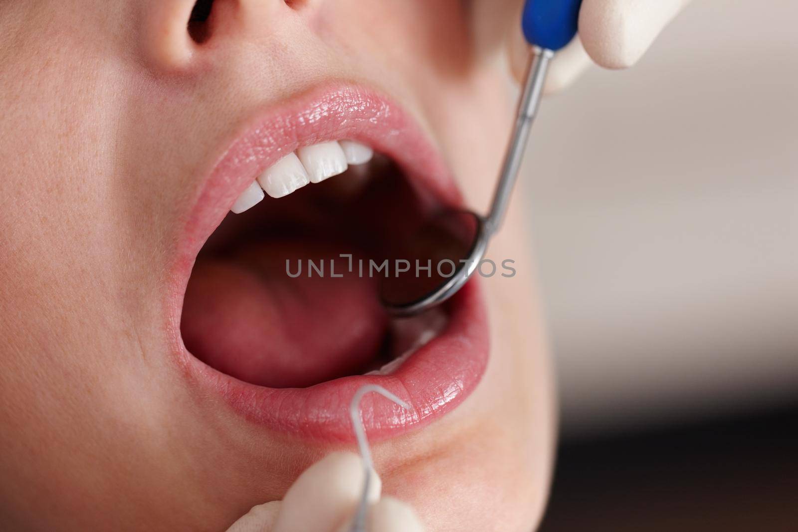 Dental examination. Closeup of female patient during dental treatment