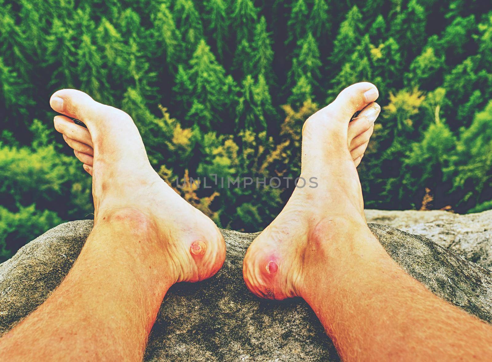 Couple hurt and tired legs resting on the top of the mountain by rdonar2