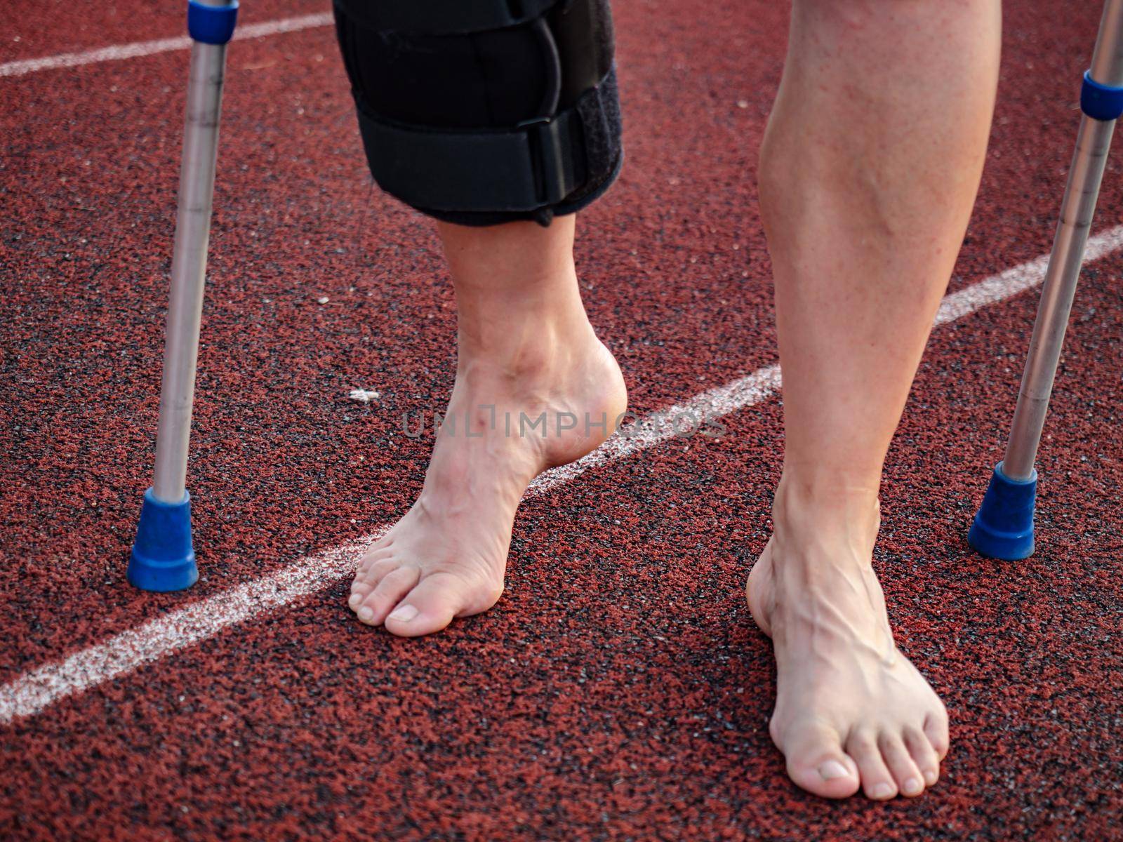 Walk by crutches. Woman runner got sports injury by rdonar2