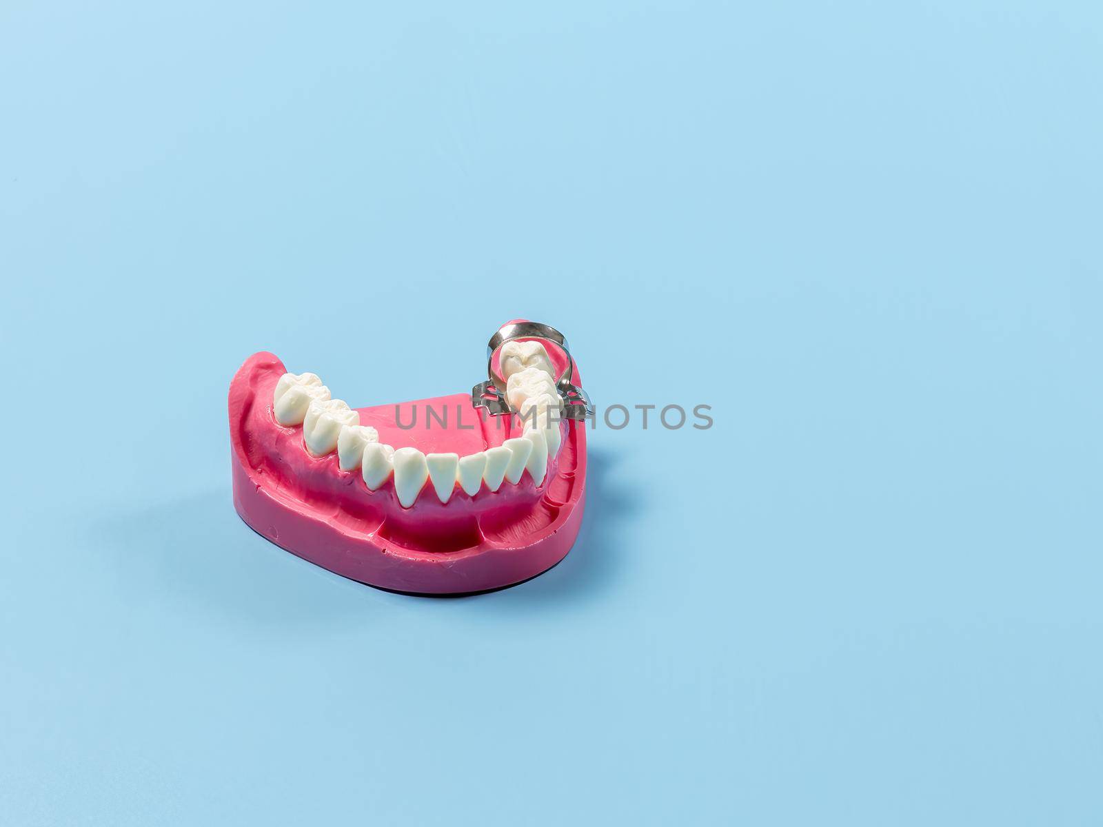 Layout of the human jaw with the clamp on the blue background. Medical tools concept. Top view.