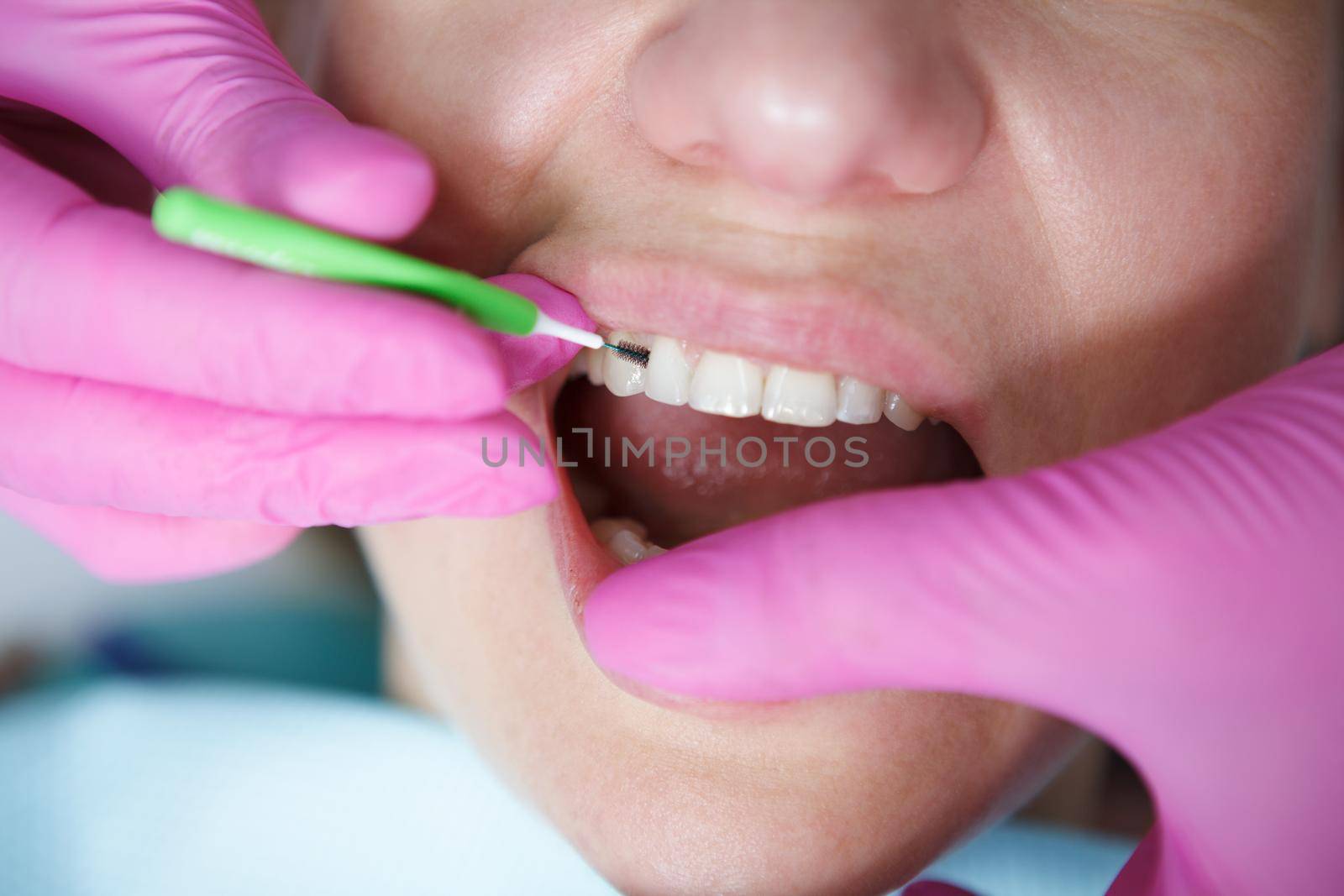 Cropped close up of dentist using interdental toothbrush cleaning between teeth of patient